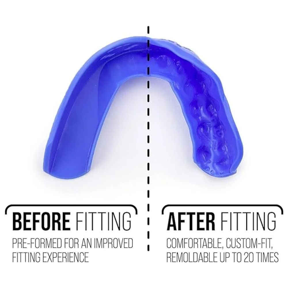 Sisu - 3D Adult Oral Care Mouthguard - Royal Blue - 2 mm