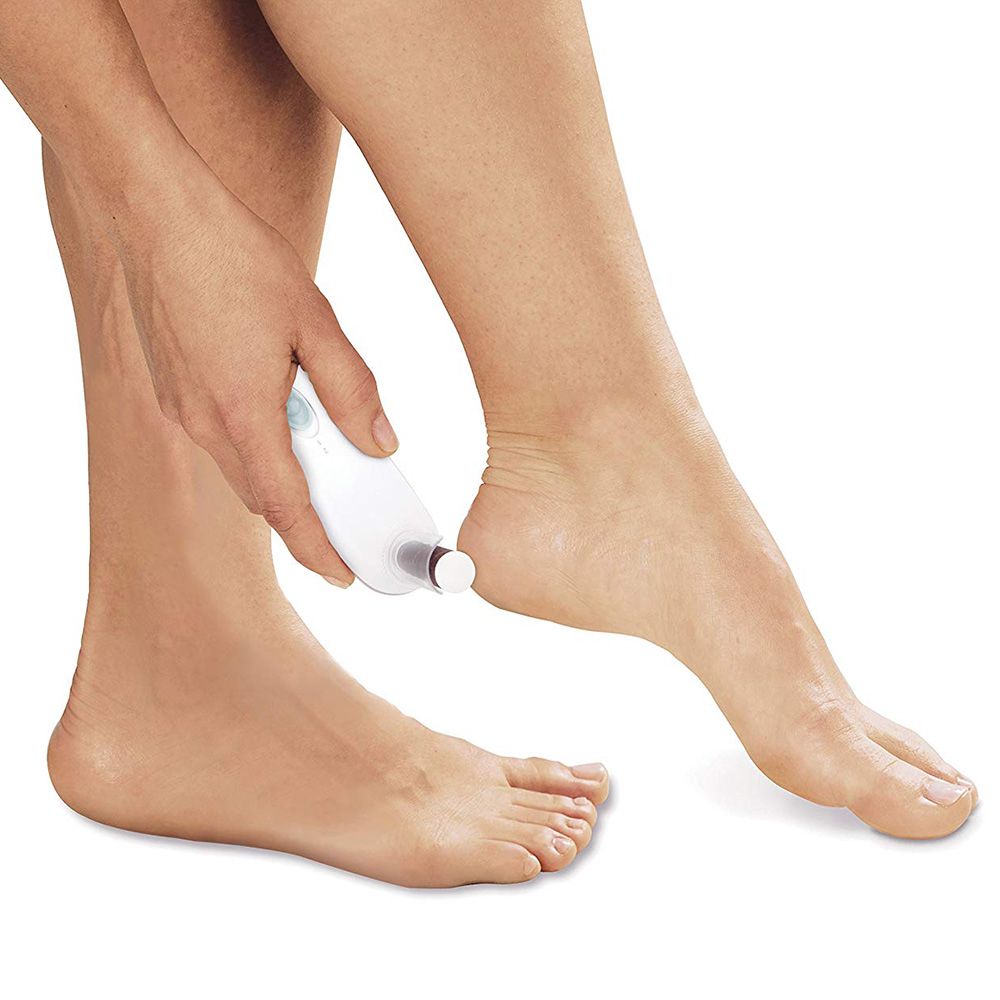 HoMedics - Elle Mcpherson 2-in-1 Heel Smoother - White